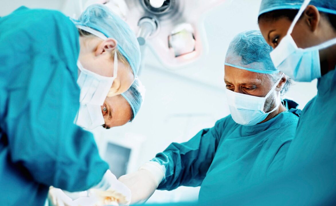 Der Prozess der Penisvergrößerung durch Chirurgen durch eine Operation
